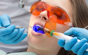 Teeth Whitening Methods