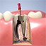 Endodonti