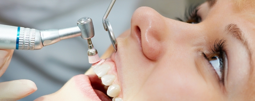 Tooth Stone Cleaning Important?